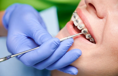 Does Getting Braces Hurt? Common Struggles With Traditional Braces (And How Denterity Eases the Pain)