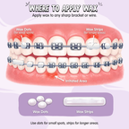 Braces Comfort Wax Kit