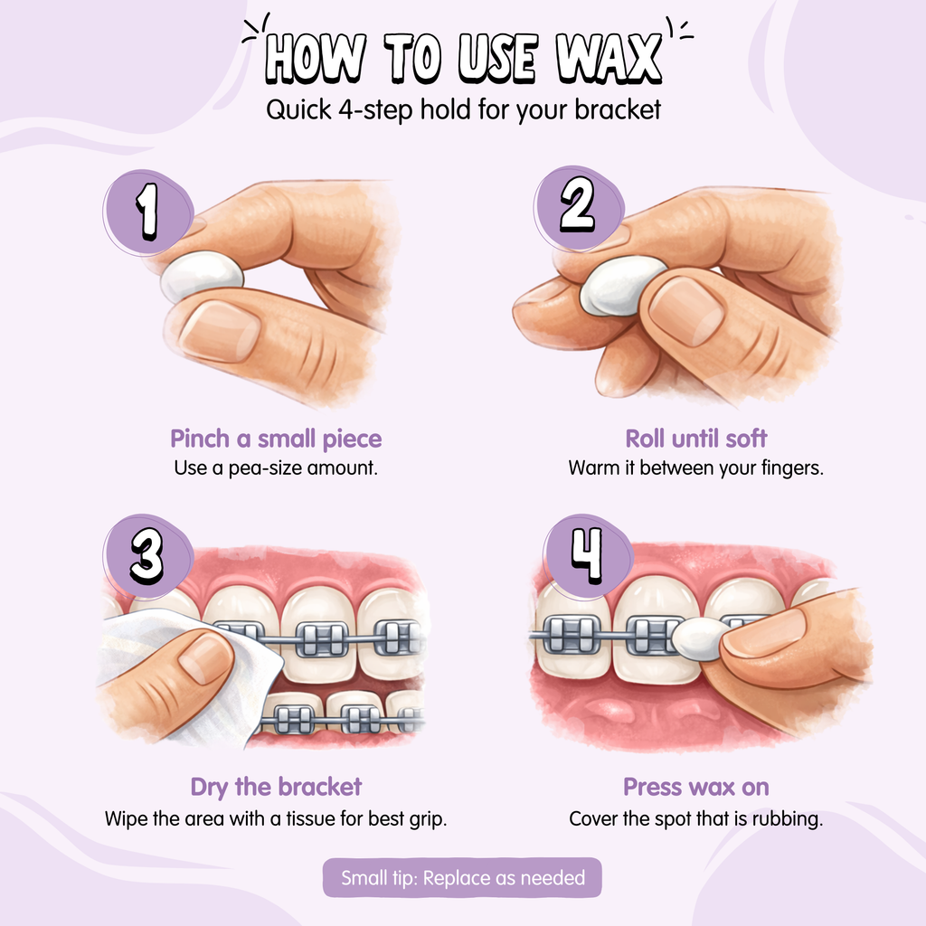 Braces Comfort Wax Kit