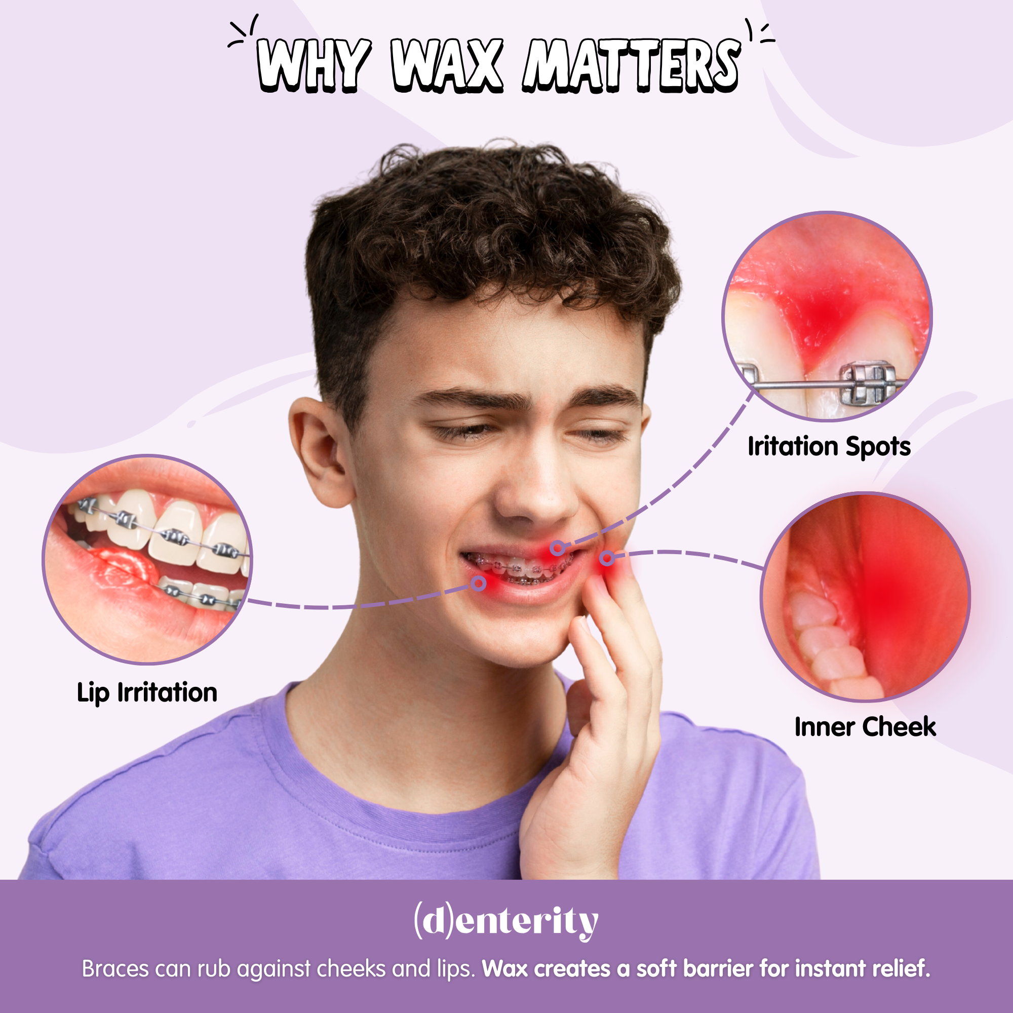 Braces Comfort Wax Kit