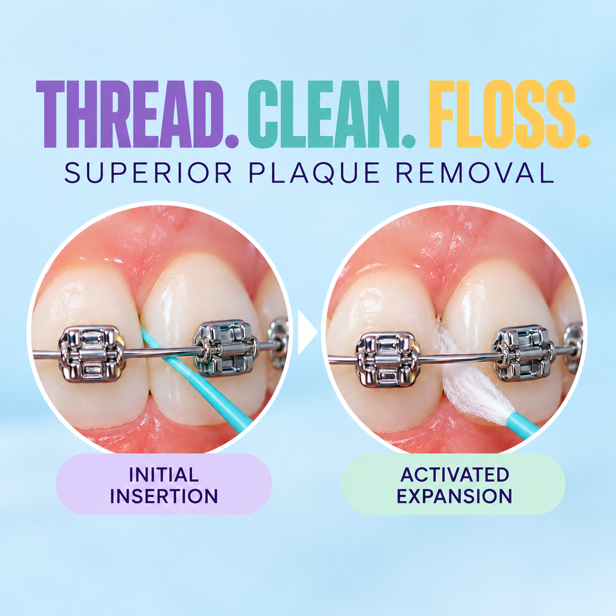 Precision Floss for Braces